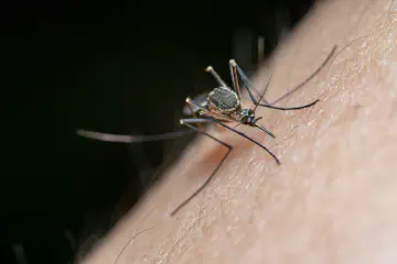 How to Get Rid of Mosquito Bites